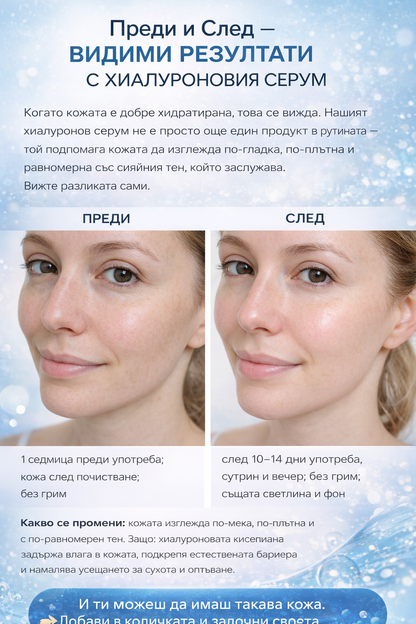 Хиалуронов серум за лице